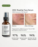 Kinvara Skincare 24Hr Rosehip Face Serum